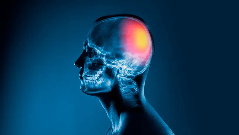 Daño cerebral adquirido