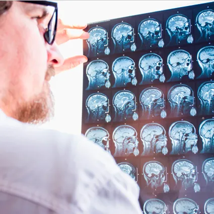 Neurología